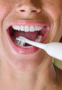 Elektrische tandenborstel met een witte handgreep en blauwe haren, gepositioneerd in een wijdopen mond die witte tanden en roze tandvlees laat zien.