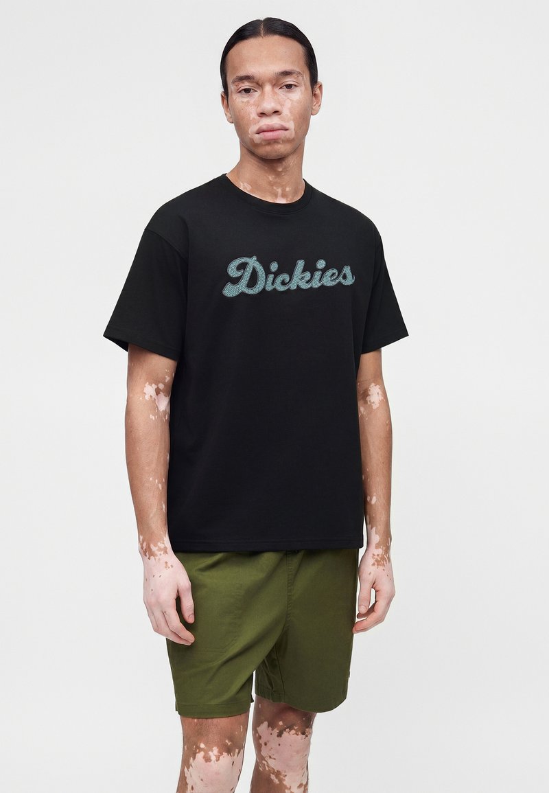 Junger Mann mit Vitiligo trägt ein schwarzes Dickies-T-Shirt und olivgrüne Shorts und steht vor einem schlichten hellen Hintergrund.