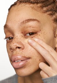 Close-up van een gezicht met een gemiddelde bruine huid, prominente sproeten en lichte make-up. Een vinger wijst naar een gemarkeerd gebied onder het oog.