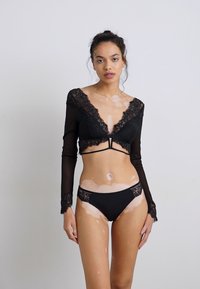 Jauna moteris su vitiligo, vilkinti juodas nėriniuotą apatinį trikotažą su ilgomis rankovėmis, stovinti prieš šviesią vientisą fono.