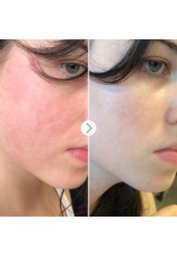 Pai Skincare THE LIGHT FANTASTIC™ CERAMIDE FACE OIL - Gezichtsolie - mixed