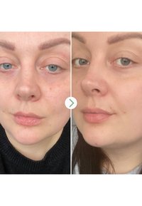 Pai Skincare ROSEHIP BIOREGENERATE™ REJUVENATING OVERNIGHT FACE OIL - Gezichtsolie - -
