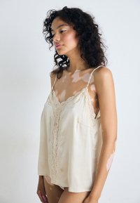 Donna con capelli ricci che indossa un canottiera in pizzo color crema, con macchie di vitiligine su braccia, spalle e petto, su uno sfondo chiaro e semplice.