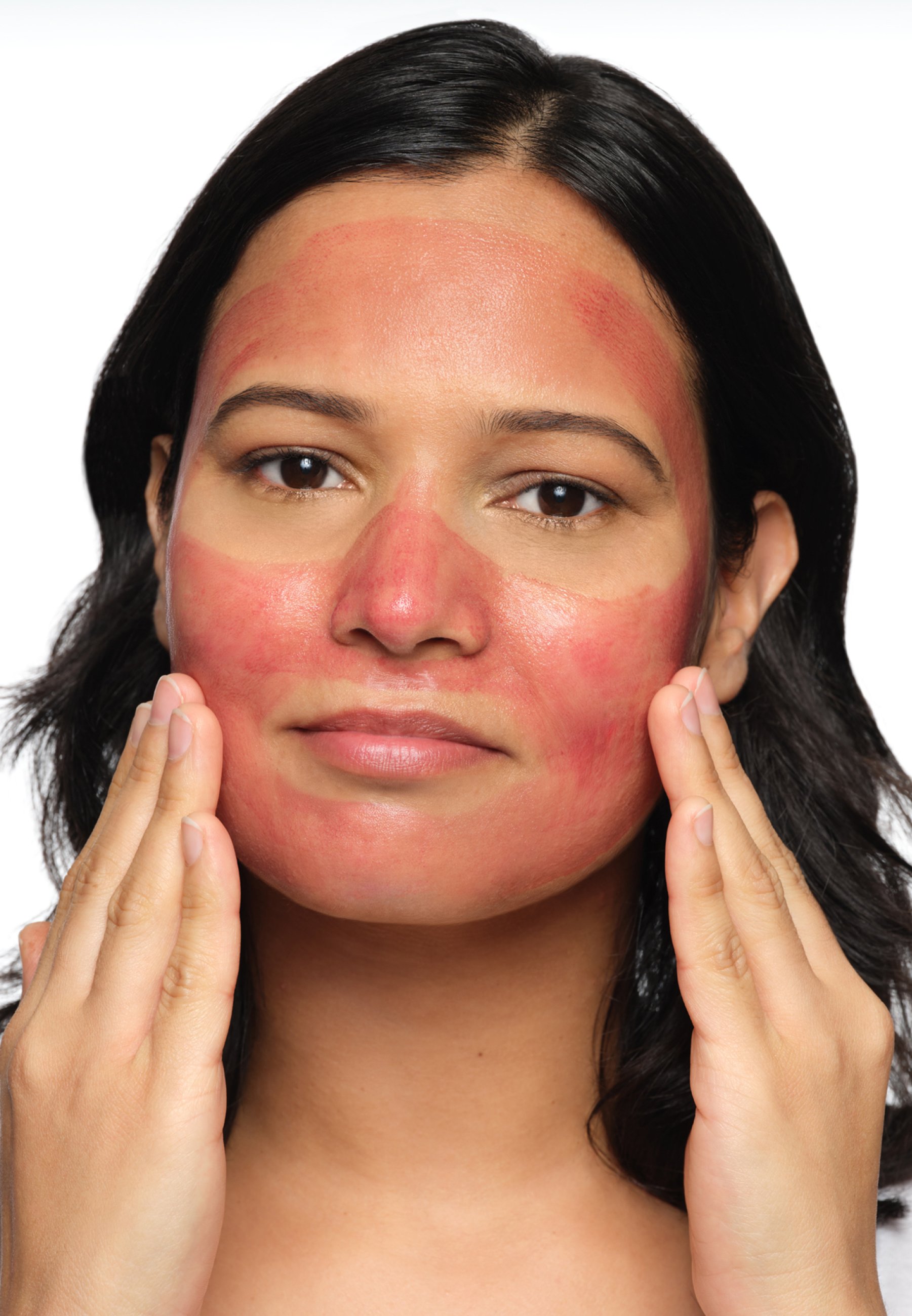 Fruchtsäure-Peeling Fürs Gesicht – 30% AHA + 2% BHA, 2 Flaschen, Für Alle Hauttypen