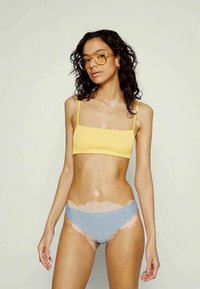 Mulher com cabelo encaracolado vestindo um top amarelo cropped, roupa interior azul e óculos com lente âmbar, exibindo manchas de vitiligo na pele.