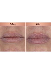 Vorher-Nachher-Vergleich der Lippen; links sind trockene, gefurchte Lippen zu sehen; rechts zeigen sich vollere, glattere Lippen mit dezentem Farbton und weniger Textur.