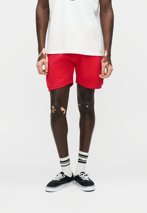 Persoon met vitiligo die een wit T-shirt, rode shorts, witte sokken met zwarte strepen en zwarte sneakers draagt, staand tegen een effen achtergrond.
