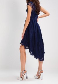 Nainen, joka on pukeutunut merensinihrun lace-mekkoon epäsymmetrisellä helmalla ja hopeisiin korkokenkiin, poseeraa käsi lantioillaan.