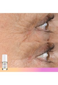 Sérum anti-âge pour les yeux dans un flacon transparent avec une pompe blanche. Gros plan de la peau sous les yeux montrant des rides avant et après l'application.