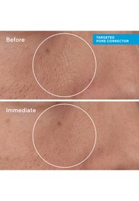 Murad TARGETED PORE CORRECTOR - Dagkräm