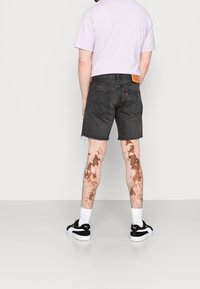Persona vista desde atrás, que lleva una camiseta lila y pantalones cortos de mezclilla negros, con marcados signos en la piel de sus piernas y zapatillas negras.