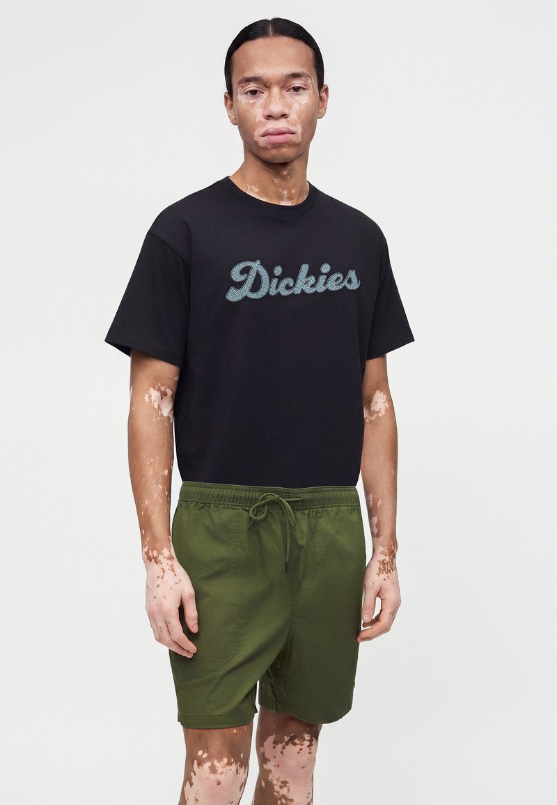 Junger Mann mit Vitiligo, der ein schwarzes Dickies-T-Shirt und grüne Shorts mit Kordelzug trägt, vor einem schlichten hellen Hintergrund stehend.