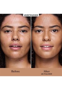 Imagen de antes y después que muestra el rostro de una persona; el lado izquierdo presenta un tono de piel irregular con imperfecciones, mientras que el lado derecho tiene la piel más suave y clara.