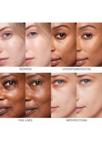 Vier Paare von Gesichtern zeigen Verbesserungen bei Rötungen, Hyperpigmentierung, feinen Linien und Unreinheiten mit klarerer, glatterer Haut nach der Behandlung.