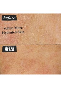 Gros plan de la peau avant et après traitement. "Avant" montre une texture sèche et rugueuse ; "Après" présente une peau plus lisse, plus hydratée avec un subtil éclat.