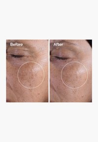 The Ordinary GLYCOLIC ACID 7% EXFOLIATING TONER - Loción