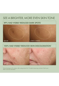 Images avant et après montrant l'amélioration du teint de la peau : textures lisses, nuances variées, zones parsemées indiquant des taches sombres et de la décoloration.