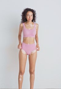 Woman with curly hair wearing pink sports bra and high-waisted underwear, standing against a plain light background, showing vitiligo skin patches.