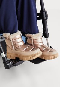 Jalad metallistest sooja voodriga talvemütse, mille ääres on karv, toetuvad ratastooli jalatoe peale, sinised püksid ulatuvad mütside kohal.