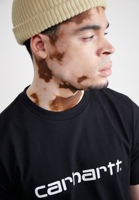 Czarna bawełniana koszulka z białym logo "carhartt". Model nosi beżową czapkę z prążkowanego materiału. Skóra ma jasne i ciemne plamy.