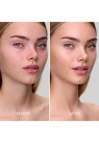 Före- och efterbilder av ett ansikte som visar tydliga förbättringar av huden; kännetecken inkluderar gröna ögon, fylliga läppar och ljusbrunt hår på en neutral bakgrund.