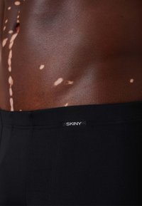 Svart elastisk tygmidja med "SKINY"-logotyp. Huden har synliga fläckar och tonvariationer. Fokusera på textur och designdetaljer.
