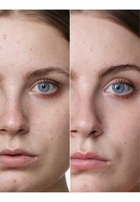 BABOR HYALURONIC ACID AMPOULE - Serum