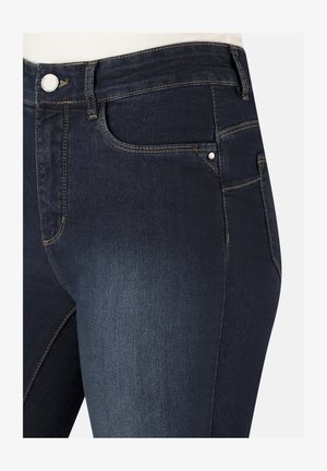 Dunkelblaue Denim-Jeans mit Front- und Seitentaschen, kontrastierenden Nähten, Knopfverschluss und dezenten, verblassten Details an den Oberschenkeln.