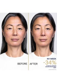 Før-og-etter sammenligning av ansikt som viser jevn hudtekstur. Venstre side viser hengende konturer; høyre side viser forbedret definisjon.