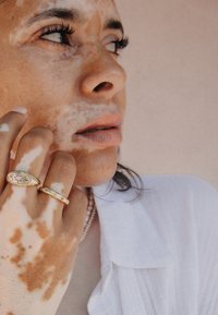 Guldringar med rosa stenar på fingrarna, texturerad hud med fläckar och en ljusfärgad skjorta; mjuk fokus på hand- och ansiktsdetaljer.