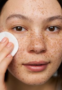 Nærbilde av et ansikt med lys hudtone og fremtredende fregner. En hånd holder en bomullspad mot kinnet. Glatte lepper, runde brune øyne.