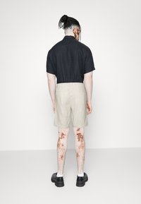 Chemise noire à manches courtes et short beige à rayures avec une coupe standard. Chaussures noires complètent la tenue. Marques visibles sur la peau des jambes.