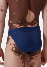Slip di cotone blu navy con una texture liscia e un'elastico in vita, indossato da un modello con una pelle caratterizzata da macchie chiare e scure.