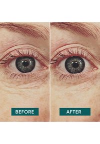 Apricot Beauty EYE PADS WITH HYALURON - Cura degli occhi