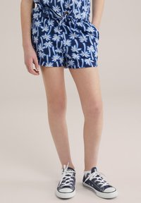 Mėlyni raštuoti šortai su baltais palmių medžių raštais, su raišteliu juosmens srityje ir šoninėmis kišenėmis, derinami su tamsiai mėlynais kanvas sportbačiais.