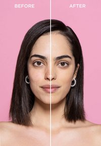 Comparaison avant-après du visage d'une femme, présentant une peau lisse à droite et une texture inégale à gauche. Elle a les cheveux lisses et foncés et de grosses boucles d'oreilles en perles.