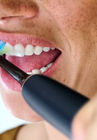Brosse à dents électrique avec un manche noir et une tête de poils bleue et blanche, brossant des dents propres ; la peau présente des taches de rousseur et une texture naturelle.