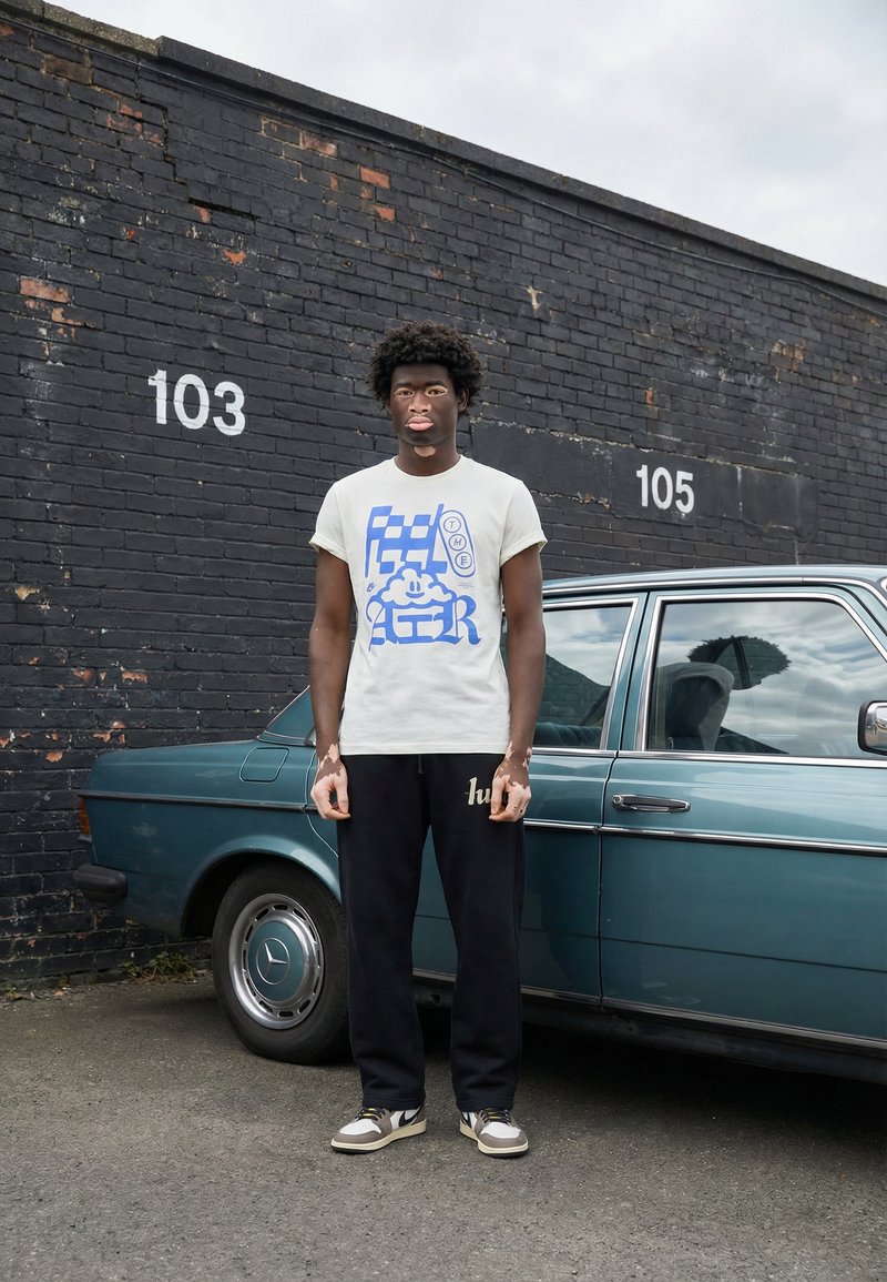 Jeune homme atteint de vitiligo se tient à côté d'une voiture bleue vintage devant un mur en briques noires portant les numéros 103 et 105.
