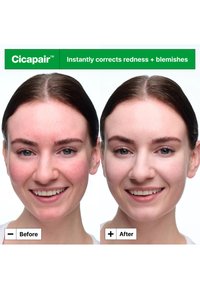 Cicapair-produkt vist i en to-delt sammenligning. Venstre: rødhet og blemmer synlige; høyre: glattere, jevn hudtone uten rødhet.
