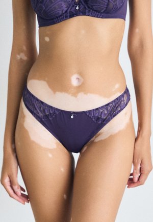 Vrouw in een paarse kanten beha en slip, met vitiligo vlekken zichtbaar op haar torso, armen en bovenbenen tegen een neutrale achtergrond.