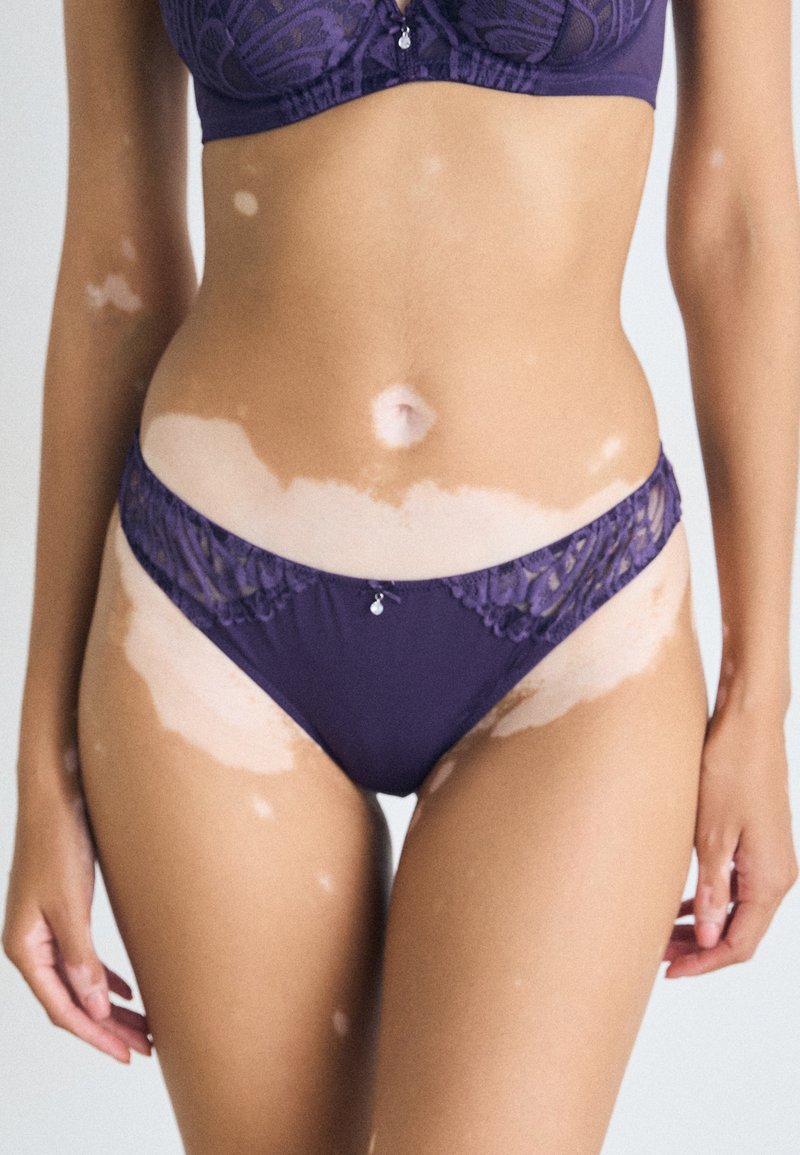 Kvinna som bär en lila spets-bh och trosor, med vitiligo-fläckar synliga på torso, armar och lår mot en neutral bakgrund.