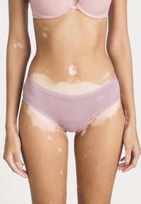 Ljusrosa bomullstrosa med spetsdetaljer som har en mjuk yta. Modellen har vitiligo-fläckar synliga mot en neutral bakgrund.