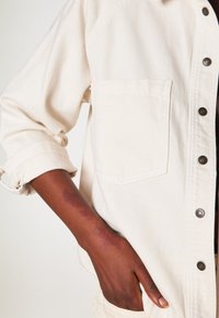 Avambraccio con un evidente livido scuro appoggiato contro una giacca color crema con bottoni, dotata di una grande tasca sul petto e manica arrotolata.