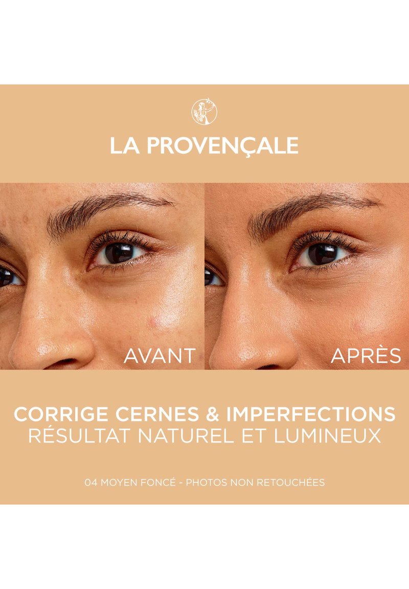 Comparaison avant-après de la peau sous les yeux, montrant une différence de ton et de texture. Le côté gauche présente des imperfections ; le côté droit paraît plus lisse et plus lumineux.
