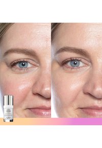 Flacon de sérum pour la peau étiqueté "Good Genes" à côté d'images avant et après de la peau. Lissage visible et réduction de la rougeur du teint.