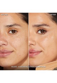 Before-and-after comparison of skin on a model's face. Left shows noticeable freckles and blemishes; right displays smooth, even-toned skin.