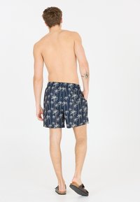 Marineblaue Badeshorts mit Palmenmuster, elastischem Bund, Seitentaschen und Schnitt über dem Knie. Tragen mit dunklen Sandalen.