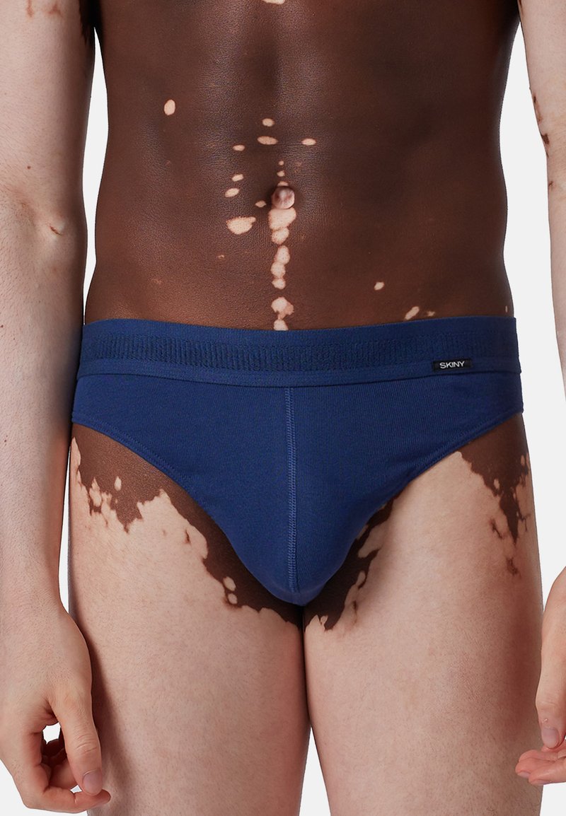 Torso maschile con vitiligine che indossa slip blu navy con un'etichetta nera "Skiny" sulla vita, su uno sfondo bianco.