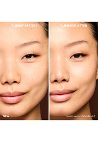 Före- och efterbilder av ett ansikte som visar skillnaden i hudstruktur; vänster med fräknar, höger med en jämnare och slätare hy.