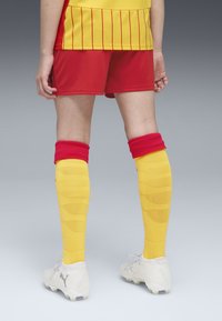 Pantalones cortos rojos, camiseta a rayas amarillas, medias amarillas hasta la rodilla con textura y zapatos de fútbol blancos con detalles grises.